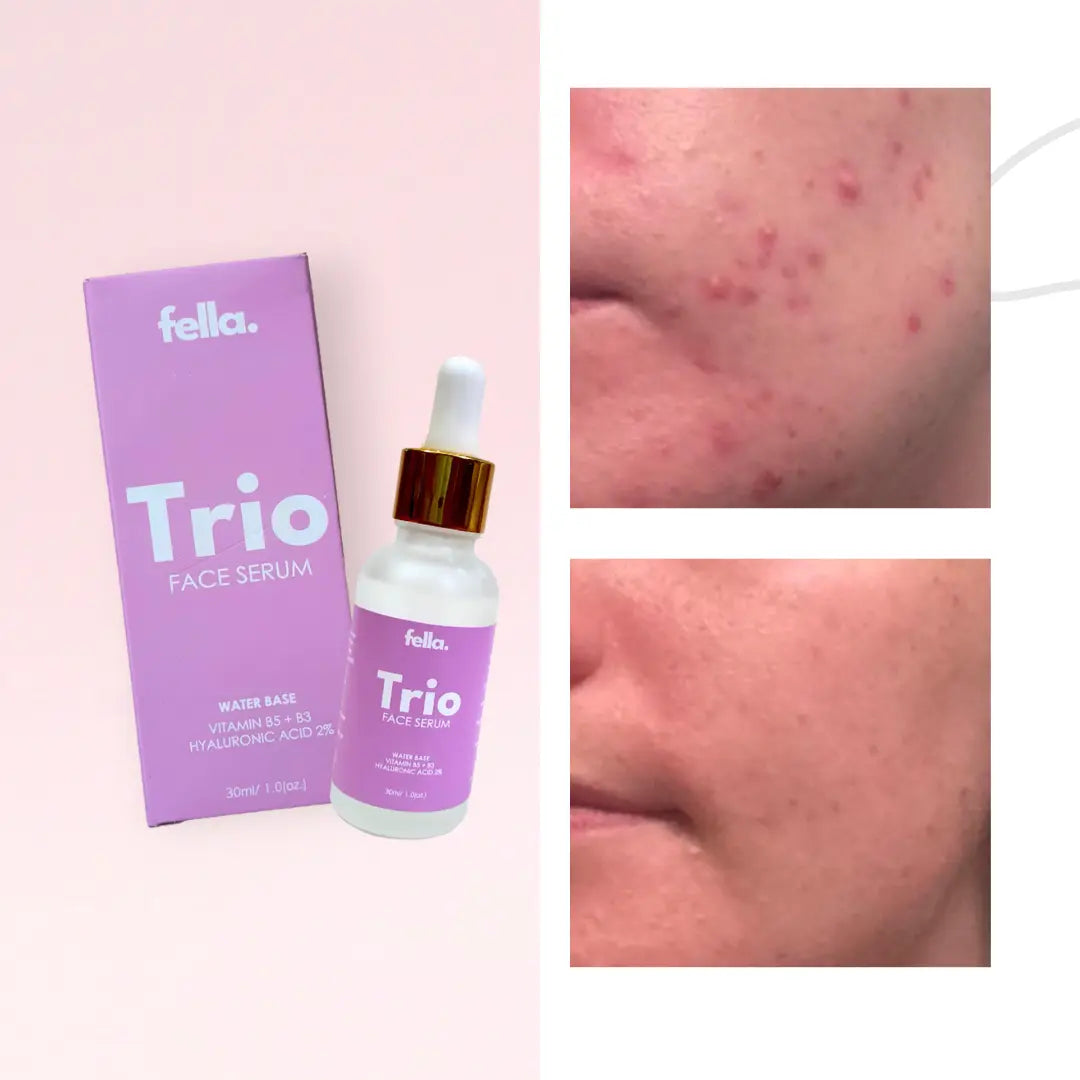 TRIO Face Serum Hayaluronic Acid 2% Hydrate skin Minimize pores - Niacinamide Vit B5 FELLA BEAUTY