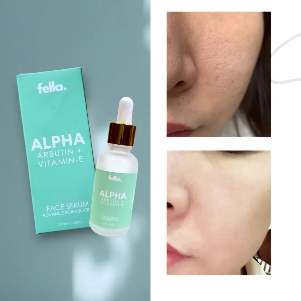 Alpha Face Feature Fella Beauty ALPHA Face Serum AlphaArbutin + Vit-E – FELLA BEAUTY™